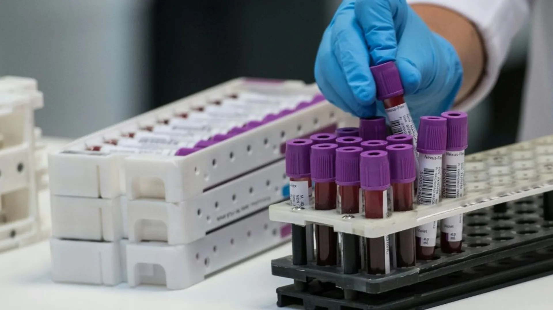 Cancer une simple prise de sang pourrait repérer et suivre la maladie — free download
