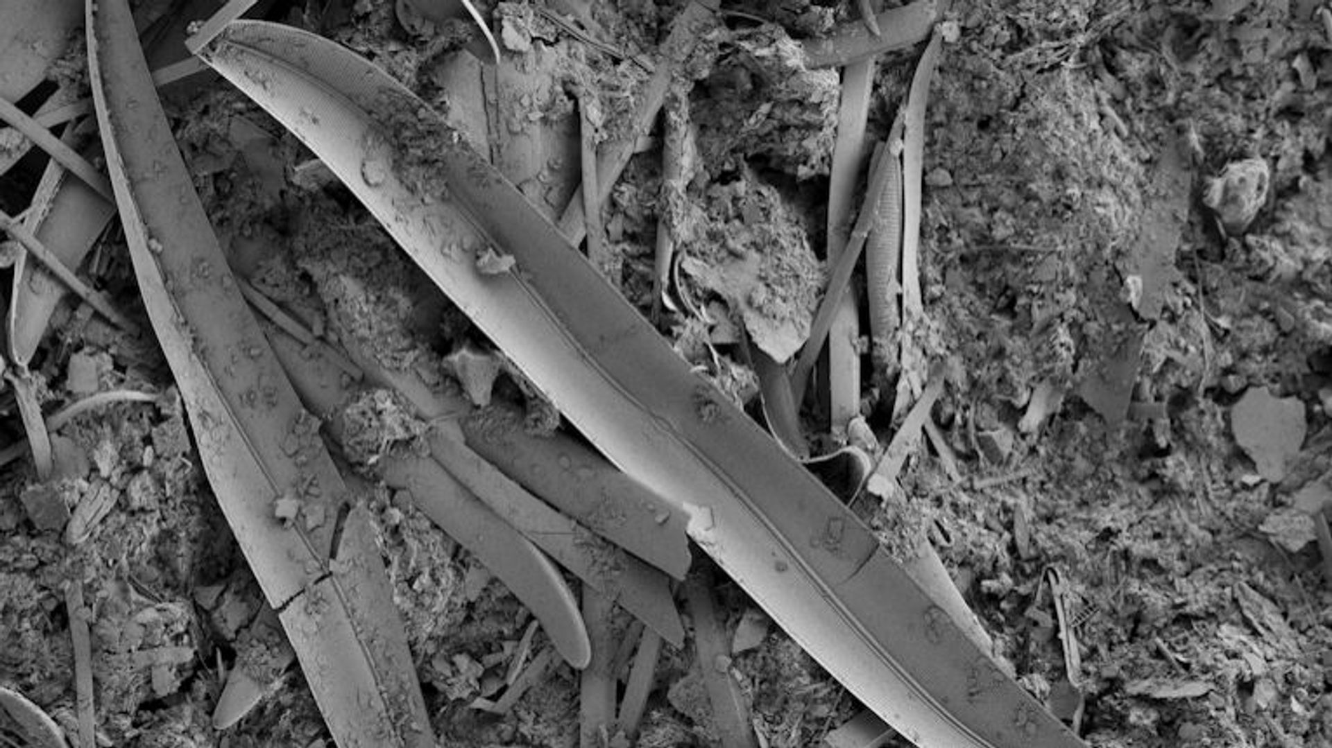 Le paradoxe de l'oxygène : pourquoi l'air que nous respirons est aussi un poison ?
