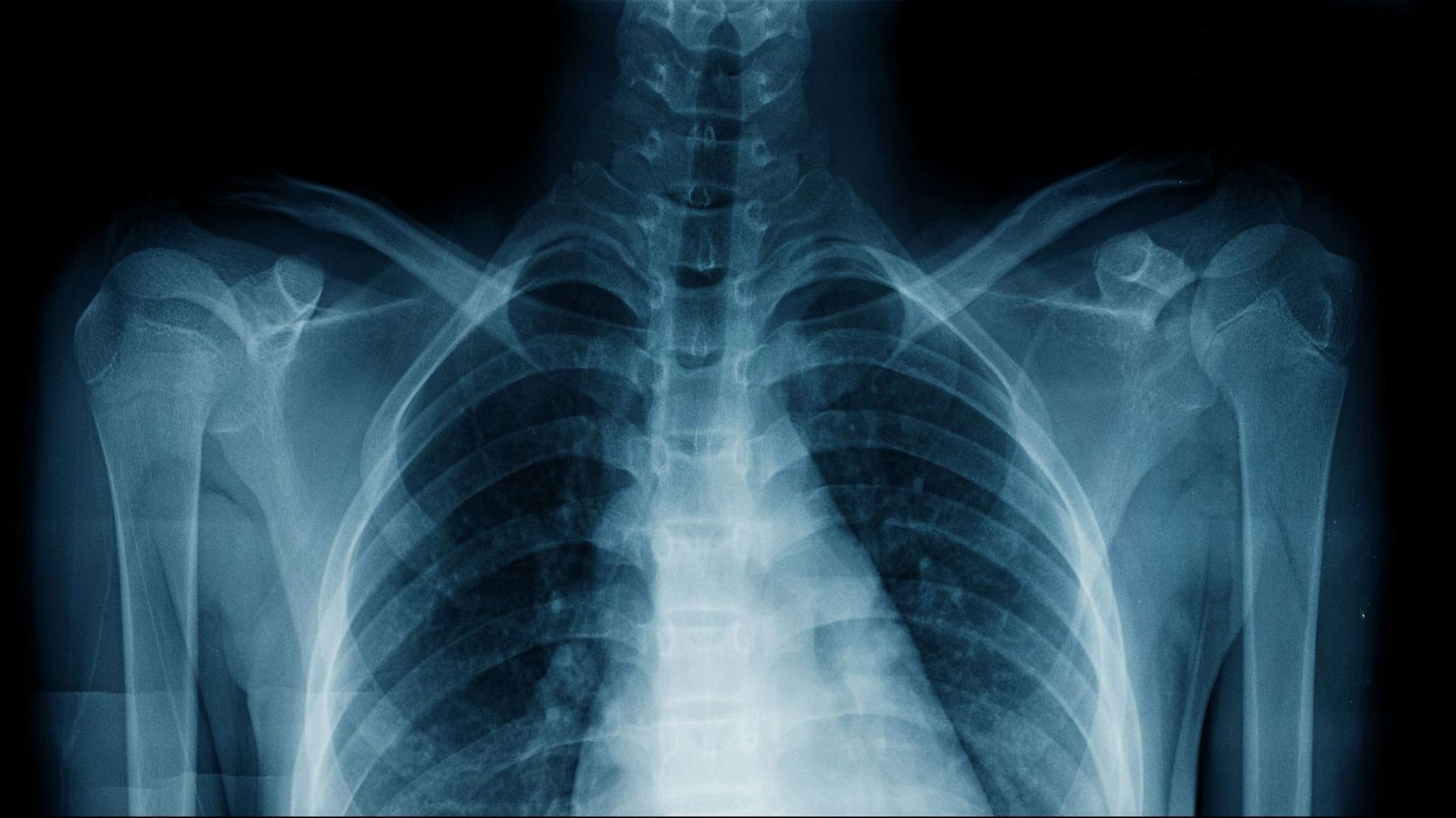 Une IA reconnait l’origine ethnique d’un humain sur les rayons X et on ne comprend pas comment - RTBF Actus