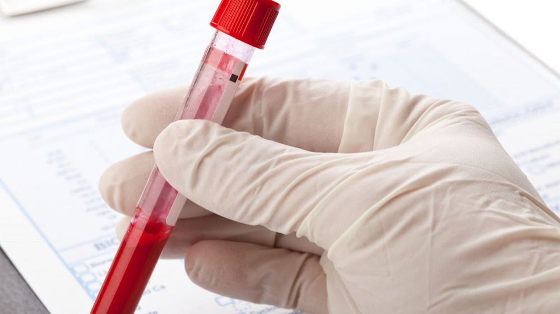 Un test sanguin prometteur pour détecter le cancer de façon précoce ...