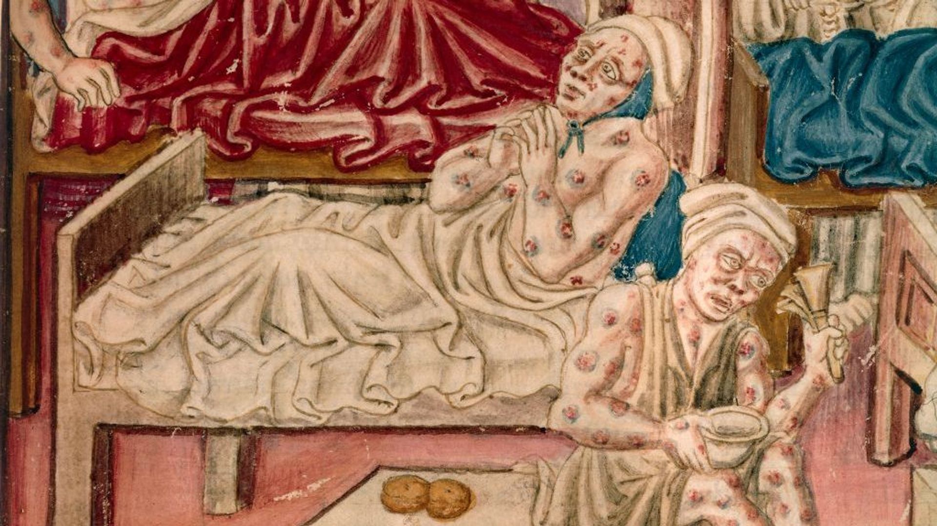 La lèpre, d'hier à aujourd'hui : "C'est le signe que tu es mort quant au monde"