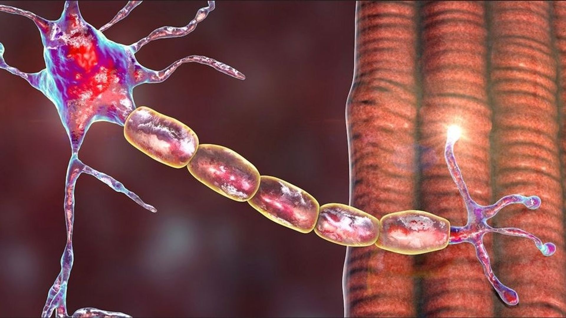 Maladie de Charcot : le mécanisme à l’origine de la forme génétique de la pathologie a été découvert