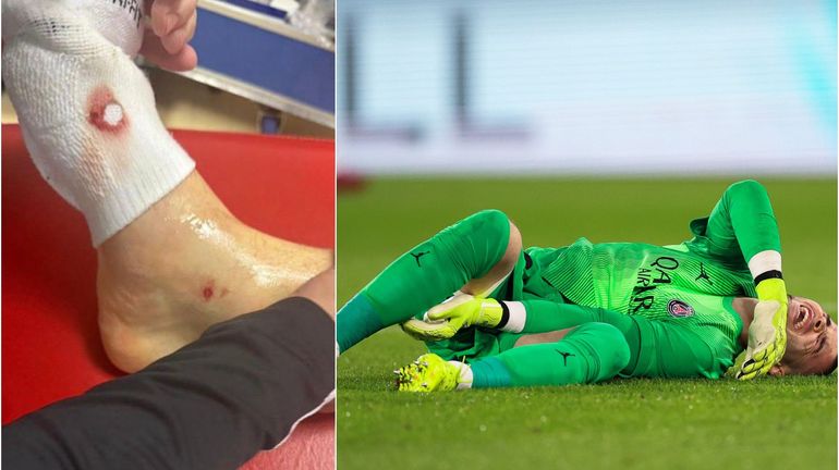 "Ma carrière aurait pu prendre un autre tournant" : Lucas Chevalier s’en sort bien après le tacle fou de Lamine Camara