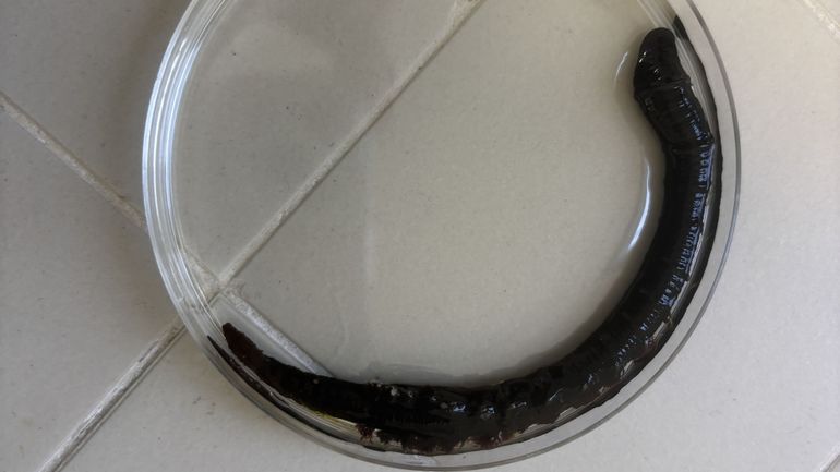 Un Œil sur demain : tous soignés grâce aux vers marins ? Voici l’histoire et la renaissance de Thomas, grand brûlé Un Œil sur demain : tous soignés grâce aux vers marins ? Voici l’histoire et la renaissance de Thomas, grand brûlé