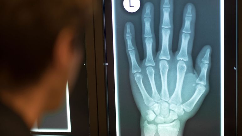 La minute insolite : un magicien perd le mot de passe de la puce insérée dans sa main