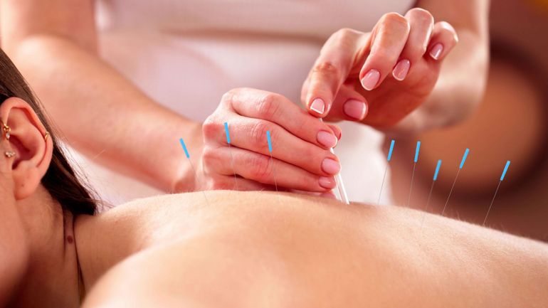 Les acupuncteurs mettent en garde après la disparition de tout cadre législatif