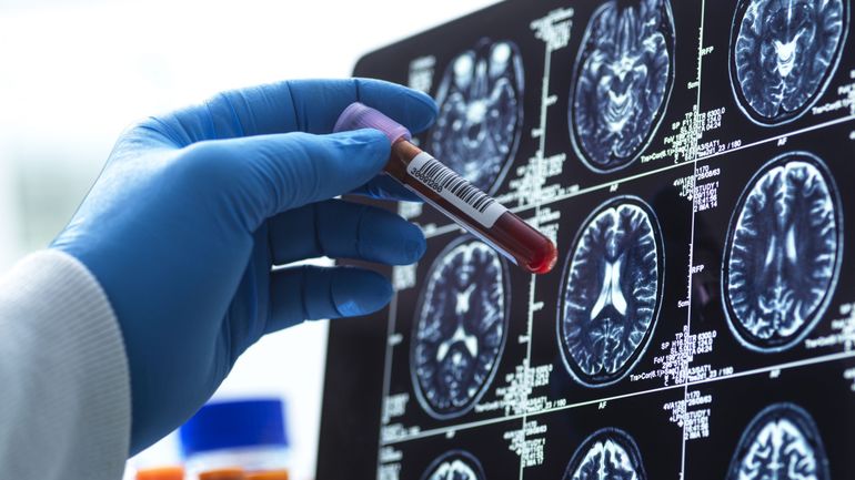 Si votre prochain avantage en nature était une espérance de vie rallongée ?