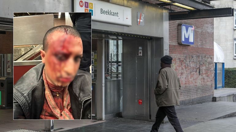 "J’étais un sac de boxe" : Jamal a été victime d’une agression transphobe et homophobe à Bruxelles