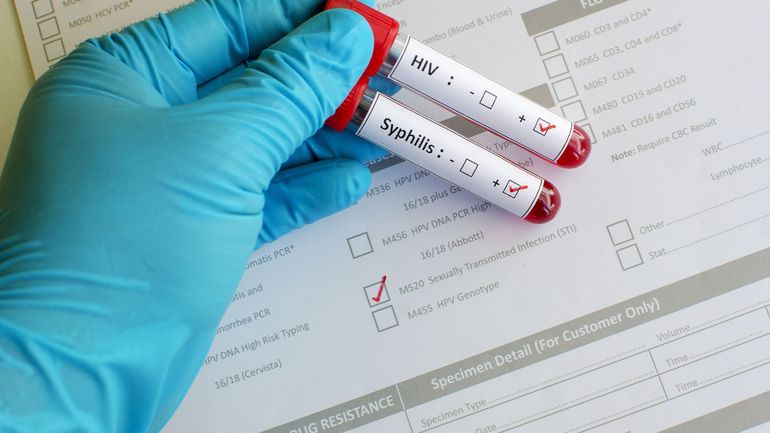 Nombre record d'infections sexuellement transmissibles en Europe : en Belgique, la gratuité du dépistage, "c'est l'exception"